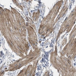 URG4 Antibody, Novus Biologicals 25 &mu;L; Unlabeled:Antibodies, Polyclonal